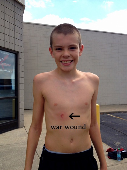 war wound